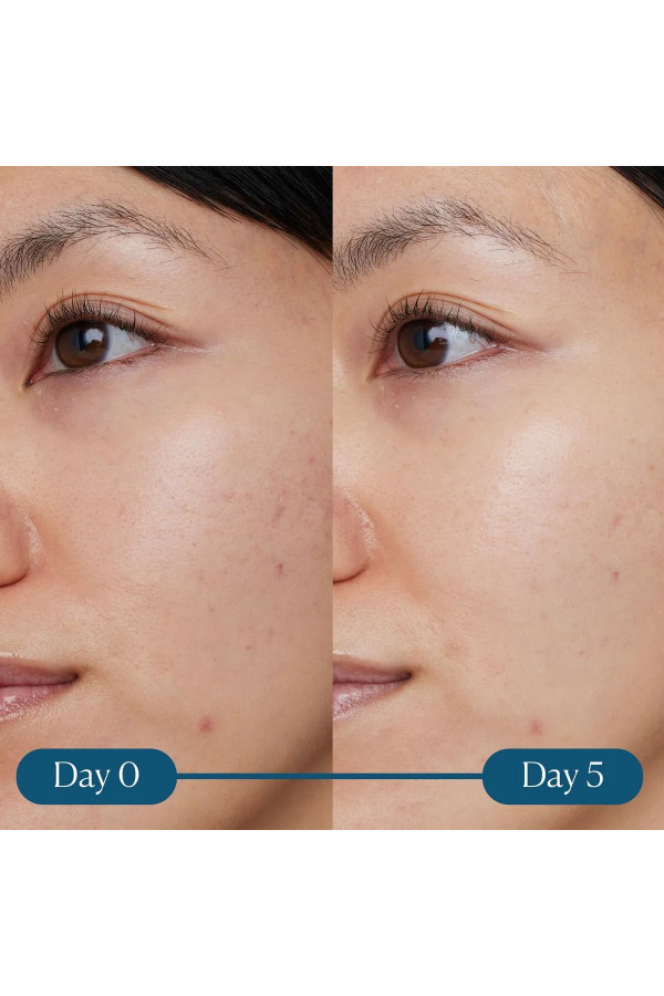 Facial Serum Elemis Dynamic Resurfacing 30 ml